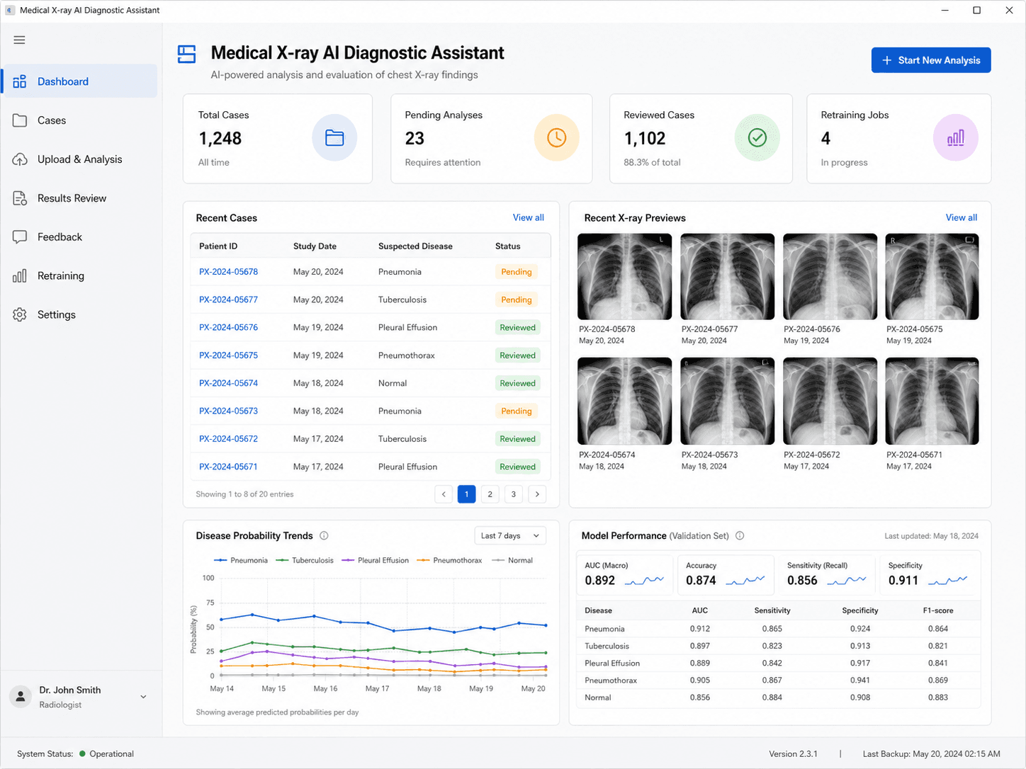 Medical X-ray AI Diagnostic Assistant